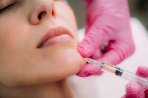 Dermal Fillers