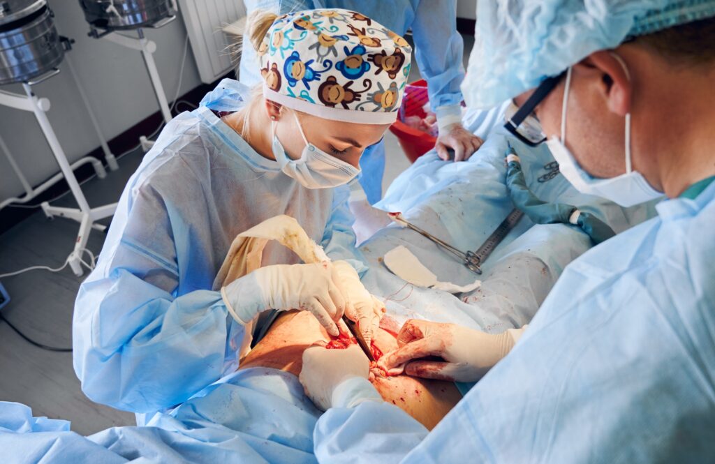 Body Contouring Surgery in Richmond, VA – Transform Your Silhouette with Expert Care