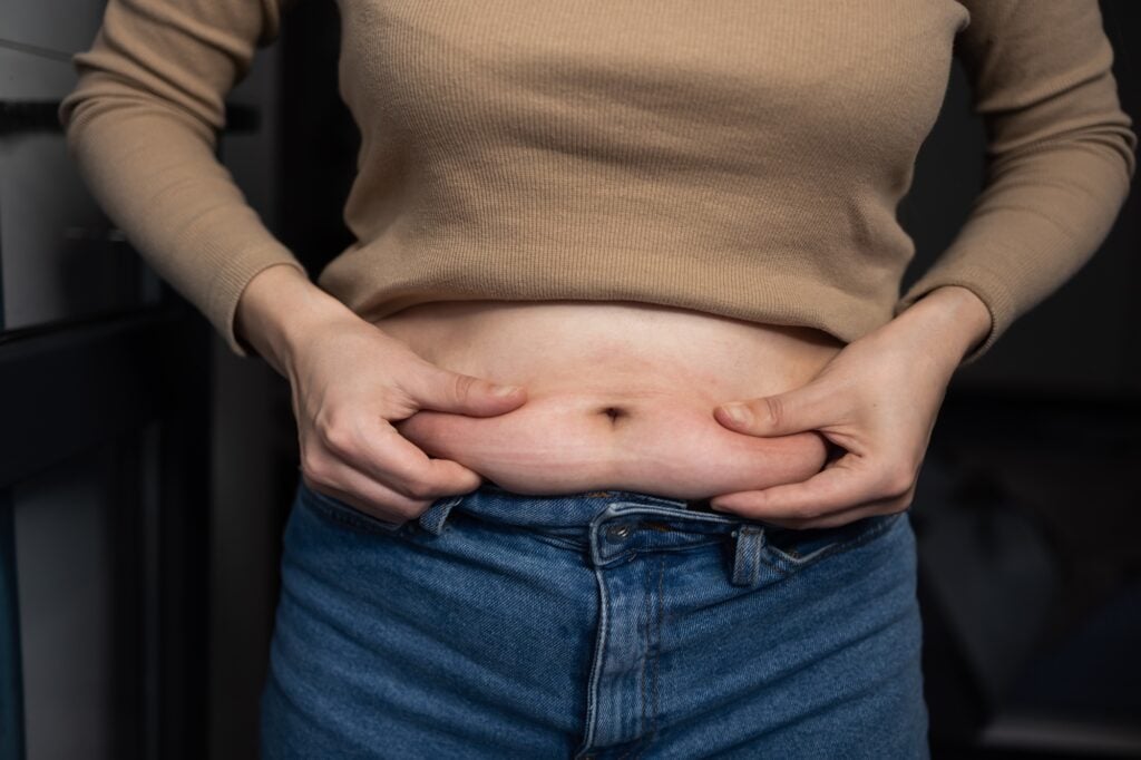 The Truth About Tummy Tuck Complications 6 Tummy Tuck Scar Healing Timeline and Phases – What Richmond Patients Can Expect