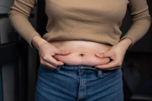 Tummy Tuck Scar Healing Timeline and Phases – What Richmond Patients Can Expect