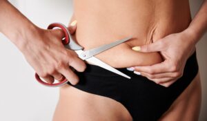 How Abdominoplasty Complements Post-Weight Loss Transformation