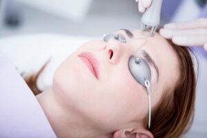 A Complete Guide to Laser Resurfacing in Richmond 1 Aesthetic surgery, CO2 laser resurfacing