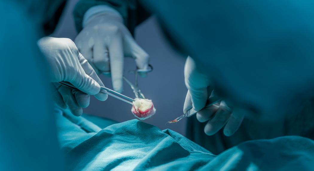 painful versus painless cyst assessment by Stanwix Plastic Surgery Richmond VA