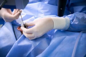 specialist about stretched earlobes at Stanwix Plastic Surgery in Richmond, VA