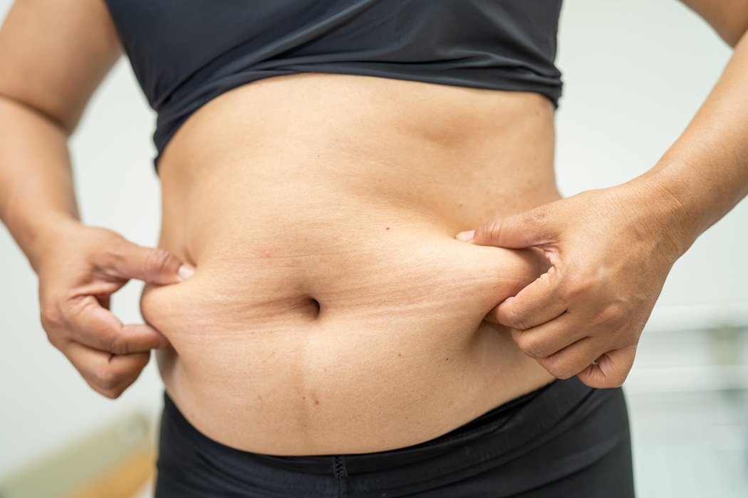 Mommy makeover treatment options at Stanwix Plastic Surgery in Richmond