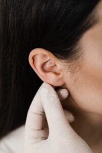 Earlobe repair consultation for enlarged piercing holes at Stanwix Plastic Surgery in Richmond