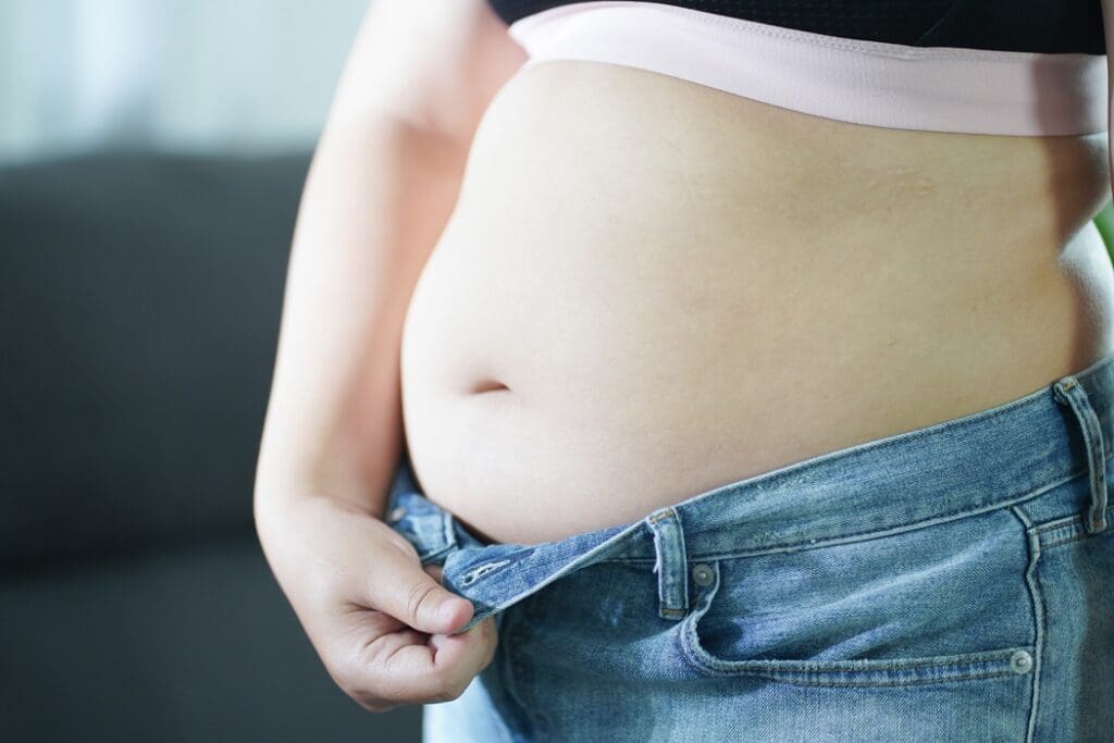 Why Does My Stomach Still Stick Out After Losing Weight? 1 Abdominal concerns after weight loss for Richmond, VA patients | Dr. Stanwix Plastic Surgery