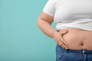 Stomach still sticking out after weight loss explained by Dr. Stanwix Plastic Surgery in Richmond